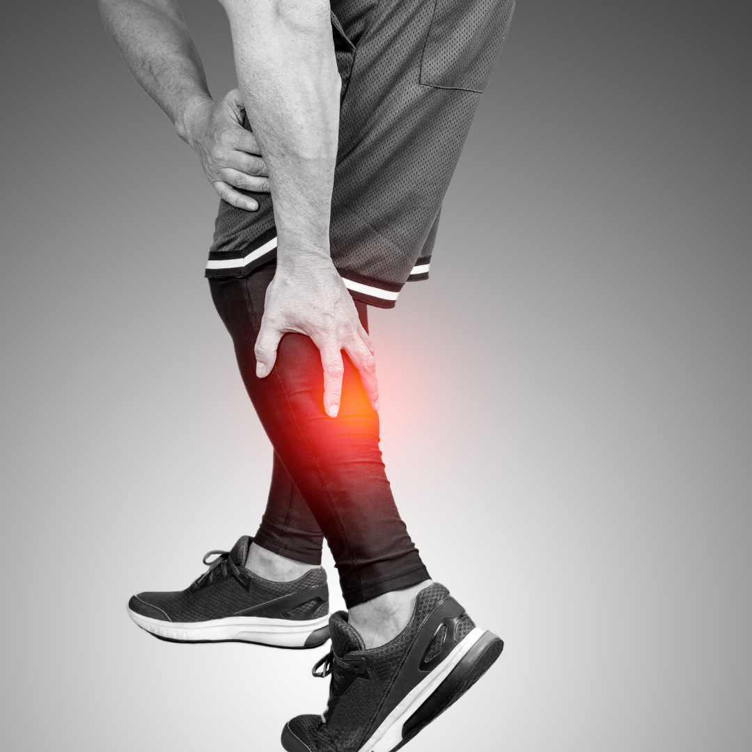 Treatment for Calf Strains Physical Therapy in Erie