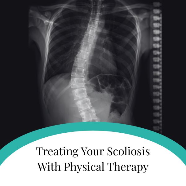 Treating Your Scoliosis With Physical Therapy